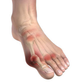 knee Toe