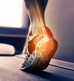 Foot Pain